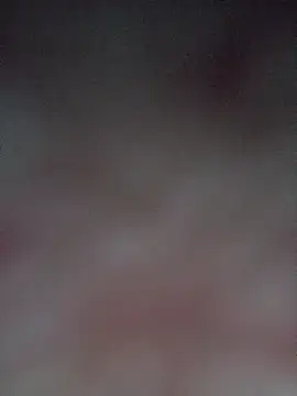 Spider bite online show from 02/23/26, 08:53