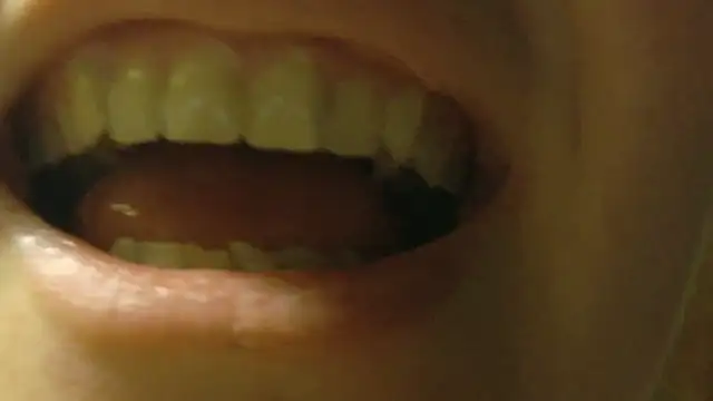 FrumCake online show from 03/23/26, 11:15